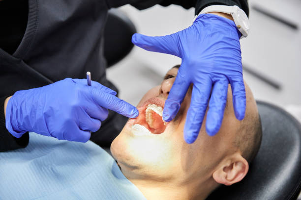 Best Walk-In Emergency Dentist in Burnsville, NC