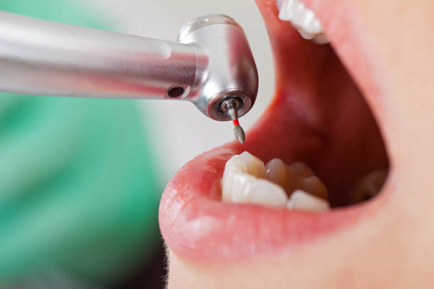 Best Walk-In Emergency Dentist in Burnsville, NC